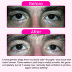 Morning Eye Rescue™ - Collagen Eye Patches