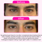 Morning Eye Rescue™ - Collagen Eye Patches