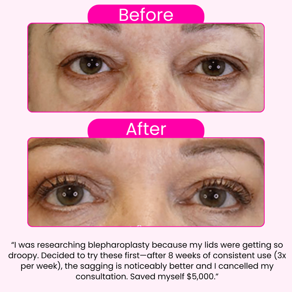 Morning Eye Rescue™ - Collagen Eye Patches