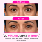 Morning Eye Rescue™ - Collagen Eye Patches