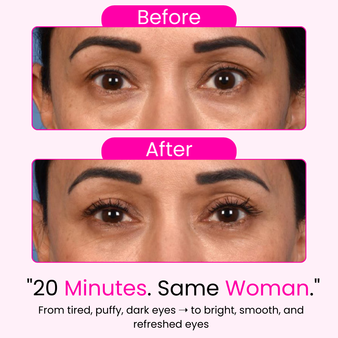 Morning Eye Rescue™ - Collagen Eye Patches