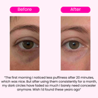 Morning Eye Rescue™ - Collagen Eye Patches