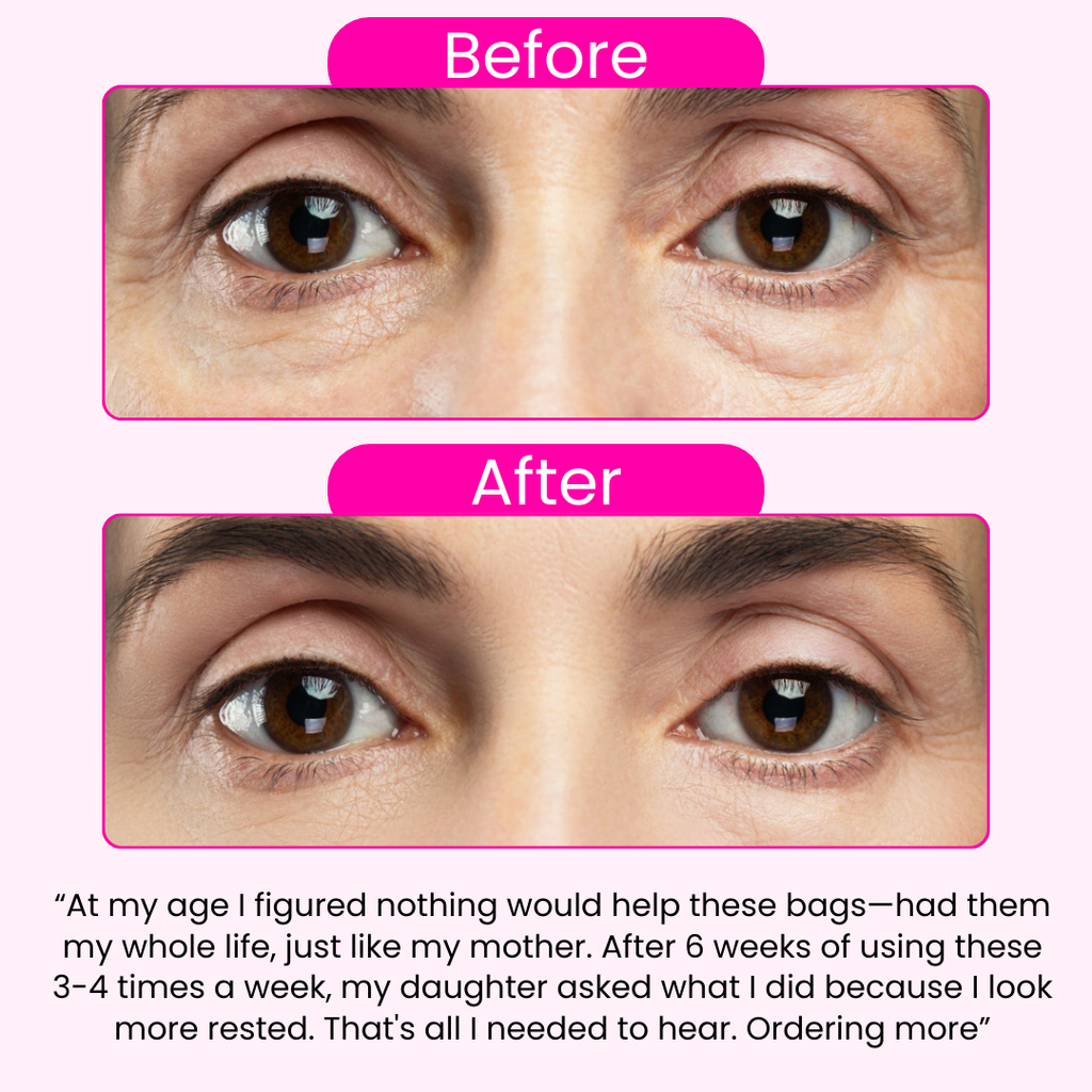 Morning Eye Rescue™ - Collagen Eye Patches